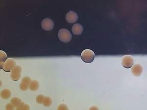 Laktzu nefermentujc bakterie (Proteus mirabilis)