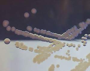 Laktzu nefermentujc bakterie (Samonella enterica)