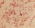 Campylobacter jejunii